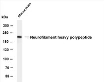 Whole cell lysates were separated by 4-8% SDS-PAGE, and the membrane was blotted with anti-Neurofilament heavy polypeptide (PT0251R) antibody. The HRP-conjugated Goat anti-Rabbit IgG(H + L) antibody was used to detect the antibody.