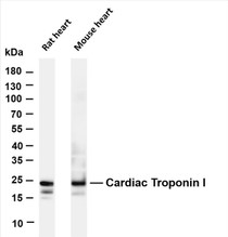 Various whole cell lysates were separated by 4-20% SDS-PAGE, and the membrane was blotted with anti-Cardiac Troponin I (PT0315R) antibody. The HRP-conjugated Goat anti-Rabbit IgG(H + L) antibody was used to detect the antibody.