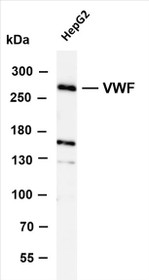 Various whole cell lysates were separated by 4-8% SDS-PAGE, and the membrane was blotted with anti- VWF (PT0316R) antibody. The HRP-conjugated Goat anti-Rabbit IgG(H + L) antibody was used to detect the antibody.