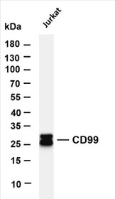Various whole cell lysates were separated by 4-20% SDS-PAGE, and the membrane was blotted with anti-CD99 (PT0343R) antibody. The HRP-conjugated Goat anti-Rabbit IgG(H + L) antibody was used to detect the antibody.