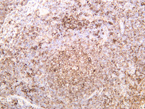 Human tonsil was stained with anti-HLA-DR (PT0377R) rabbit antibody
