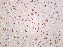 Rat brain was stained with anti-Parvalbumin (PT0465R) rabbit antibody