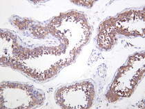 Human testis was stained with anti-TBK1 (PT0490R) rabbit antibody