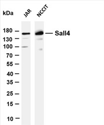 Various whole cell lysates were separated by 4-20% SDS-PAGE, and the membrane was blotted with anti-Sall4 (PT0614R) antibody. The HRP-conjugated Goat anti-Rabbit IgG(H + L) antibody was used to detect the antibody.