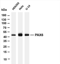 Various whole cell lysates were separated by 4-20% SDS-PAGE, and the membrane was blotted with anti-PAX6 (PT0618R) antibody. The HRP-conjugated Goat anti-Rabbit IgG(H + L) antibody was used to detect the antibody.