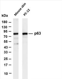 Various whole cell lysates were separated by 4-20% SDS-PAGE, and the membrane was blotted with anti-p63 (PT0645R) antibody. The HRP-conjugated Goat anti-Rabbit IgG(H + L) antibody was used to detect the antibody.