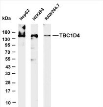 Various whole cell lysates were separated by 4-20% SDS-PAGE, and the membrane was blotted with anti-TBC1D4 (PT0652R) antibody. The HRP-conjugated Goat anti-Rabbit IgG(H + L) antibody was used to detect the antibody.