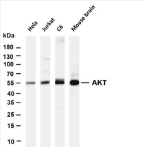 Various whole cell lysates were separated by 4-20% SDS-PAGE, and the membrane was blotted with anti-AKT (PT0654R) antibody. The HRP-conjugated Goat anti-Rabbit IgG(H + L) antibody was used to detect the antibody.