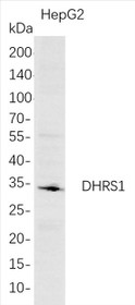 Western Blot analysis of HepG2 whole cell lysates were separated by 4-20% SDS-PAGE, and the membrane was blotted with anti-DHRS1 rabbit mAb. The HRP-conjugated Goat anti-Rabbit IgG(H + L) antibody was used to detect the antibody.