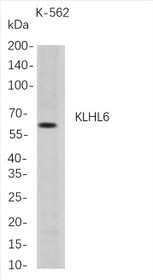 Western Blot analysis of K-562 whole cell lysates were separated by 4-20% SDS-PAGE, and the membrane was blotted with anti-KLHL6 rabbit mAb. The HRP-conjugated Goat anti-Rabbit IgG(H + L) antibody was used to detect the antibody.