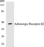 Western blot analysis of extracts from NIH-3T3 cells, using Adrenergic Receptor beta2 (Ab-346) Antibody. 