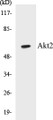 Western blot analysis of extracts from A2780 cells, treated with TNF-α, using Akt2 (Ab-474) Antibody. 