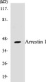 Western blot analysis of extracts from A549 cells, treated with Etoposide 25uM 60', using Arrestin 1 (Ab-412) Antibody. 