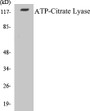 Western blot analysis of extracts from COS7 cells, treated with Calyculin 50nM 30', using ATP-Citrate Lyase (Ab-454) Antibody. 