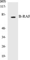 Western blot analysis of extracts from rat brain, using B-Raf (Ab-753) Antibody.