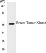 Western blot analysis of extracts from LOVO cells, using Breast Tumor Kinase Antibody. 