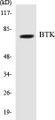Western blot analysis of extracts from HeLa cells, using BTK (Ab-222) Antibody. 