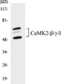 Western blot analysis of extracts from rat brain cells, using CaMK2-beta/gamma/delta (Ab-287) Antibody. 