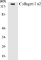 Western blot analysis of the lysates from 293 cells using Collagen I α2 antibody.