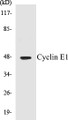Western blot analysis of extracts from HeLa cells, treated with Paclitaxel 1uM 60', using Cyclin E1 (Ab-395) Antibody. 