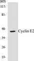 Western blot analysis of extracts from COLO/Jurkat cells, using Cyclin E2 (Ab-392) Antibody. 