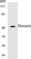 Western blot analysis of extracts from 293 cells, using Dematin (Ab-403) Antibody. 