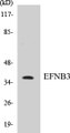 Western blot analysis of extracts from SKOV3 cells, using EFNB3 Antibody. 