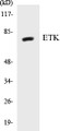 Western blot analysis of extracts from HepG2 cells, using ETK (Ab-40) Antibody. 