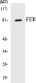 Western blot analysis of extracts from HeLa cells treated with paclitaxel 1uM 24h, using FER (Ab-402) Antibody.