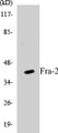 Western blot analysis of extracts from LOVO cells, using Fra-2 Antibody. 