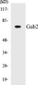 Western blot analysis of extracts from Jurkat cells, treated with TNF 2500U/ml 30', using Gab2 (Ab-623) Antibody. 