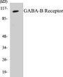Western blot analysis of extracts from HeLa cells, using GABA-B Receptor Antibody. 