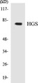 Western blot analysis of extracts from 293/COLO/HuvEc cells, using HRS (Ab-334) Antibody. 