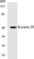 Western blot analysis of extracts from HeLa cells, using Keratin 20 Antibody. 