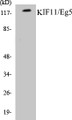 Western blot analysis of extracts from Jurkat/HepG2/COS cells, using KIF11/Eg5 (Ab-927) Antibody. 