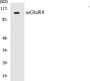 Western blot analysis of extracts from 293 cells, treated with Forskolin 40nM 30', using mGluR4 Antibody. 