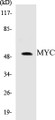 Western blot analysis of extracts from HeLa cells, treated with Forskolin 40nM 30', using MYC (Ab-62) Antibody. 