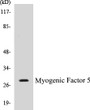 Western blot analysis of extracts from COS7 cells, using MYF5 (Ab-49) Antibody. 