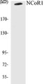 Western blot analysis of extracts from MDA-MB-435 cells, using NCoR1 Antibody. 