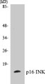 Western blot analysis of extracts from HeLa cells, using p16 INK Antibody. 