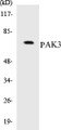 Western blot analysis of extracts from rat heart cells, using PAK3 (Ab-154) Antibody. 