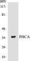 Western blot analysis of the lysates from HT-29 cells using PHCA antibody.