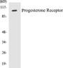 Western blot analysis of extracts from COS7 cells, treated with EGF, using Progesterone Receptor (Ab-190) Antibody. 