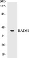 Western blot analysis of extracts from LOVO cells, using RAD51 (Ab-315) Antibody. 
