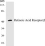 Western blot analysis of extracts from HepG2 cells, using Retinoic Acid Receptor beta Antibody. 