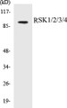 Western blot analysis of extracts from Jurkat cells, using RSK1/2/3/4 (Ab-221/227/S218/232) Antibody. 