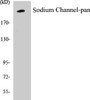 Western blot analysis of extracts from HuvEc cells, using Sodium Channel-pan Antibody. 