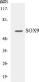 Western blot analysis of extracts from 293 cells, treated with PBS 60', using SOX9 (Ab-181) Antibody. 