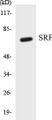 Western blot analysis of extracts from NIH-3T3 cells, treated with PMA 125ng/ml 30', using SRF (Ab-99) Antibody. 