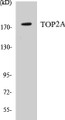 Western blot analysis of extracts from LOVO cells, using TOP2A (Ab-1106) Antibody.